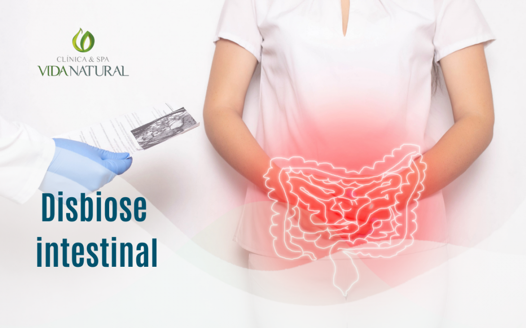 Você tem disbiose intestinal? Conheça os sintomas!